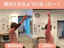 さくら/痛かった肩が挙がる～♪