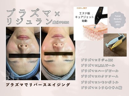 ミロク(369)の写真