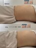 【痩身◎ウエスト周りくびれケア！】気になるお腹を重点的に♪¥5,800