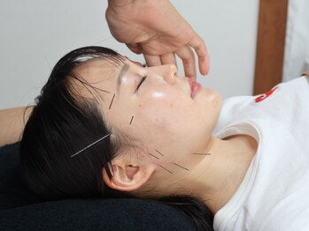 鍼灸院アール エー シー(R A C)の写真/《人気No.1☆首、肩、歯ぎしり、腰　オーダーメイド鍼灸》施術後、体の状態を数値化したレポート付。