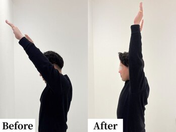 ソレア(Solea)/巻き肩・肩と腕の上がりずらさ