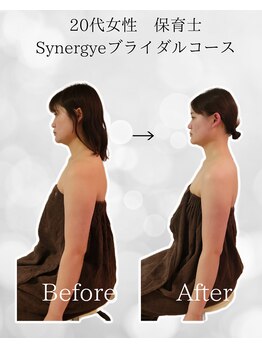 シナジェ 並木通り店(Synergye)/ブライダルケア◎痩身スリミング