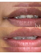 ギンザ111 プライベートルーム(Ginza 111 Private room)/【ルメラ】唇ケア