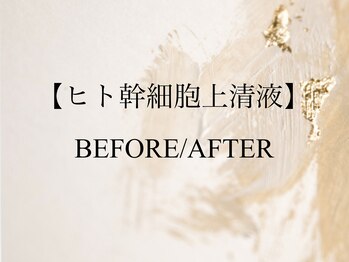 アンス(anth:)/当サロンのお客様の仕上がり