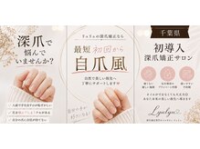リュリュの雰囲気（・周りにバレずに深爪矯正できます）