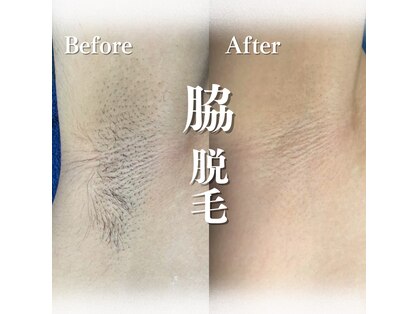 リセア(RISEA)の写真