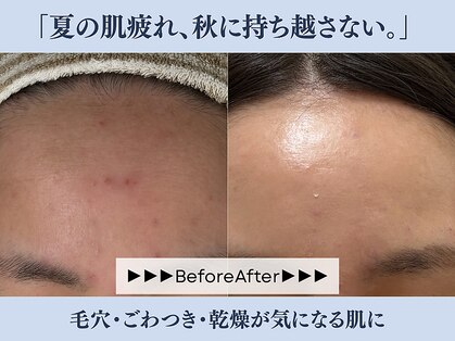 サロン コムモア(salon COMME MOI)の写真