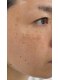 スキンラボプラス(SKIN LABO +)の写真/県内希少なIPLア導入店!くすみやシミケアで透明感のある陶器肌へ♪