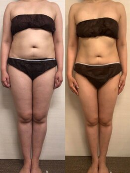 ジュメル 恵比寿店(Jumelles)/全身ケアコース