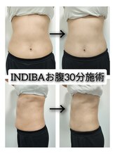 ビー アンド エイチ(B&H)/お腹インディバ30分