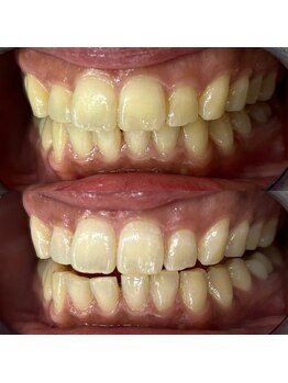 ライトビューティー 池袋店(LightBeauty)/症例写真