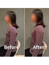 パレット(PALETTE)/【施術風景】鍼灸/全身整体