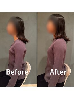 パレット(PALETTE)/【施術風景】鍼灸/全身整体