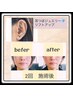 美容人気NO1”リフトアップ”耳つぼ20分¥3,000（税込）