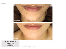 シズク ビューティーサロン(SHIZUKU beauty salon )/