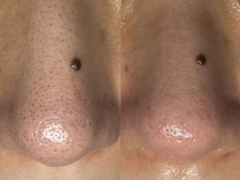 サラグランデ(Sara Grande)/ビフォーアフター