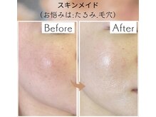 リラクゼーションサロン ラキ(laki)/スキンメイド/トロイアルケ