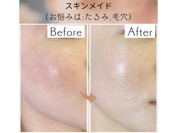 リラクゼーションサロン ラキ(laki)/スキンメイド/トロイアルケ
