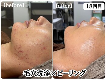 ボディコンディション