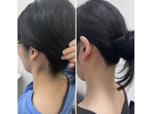 ミース 宮崎店/うなじ脱毛の効果は抜群！
