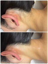 リクラ 北千住(Reclat)/