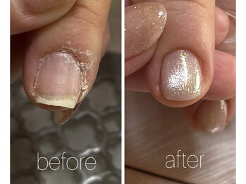 硬い角質バイバイ！