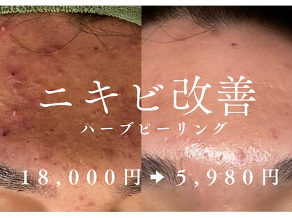 アルト(ALTO)の写真