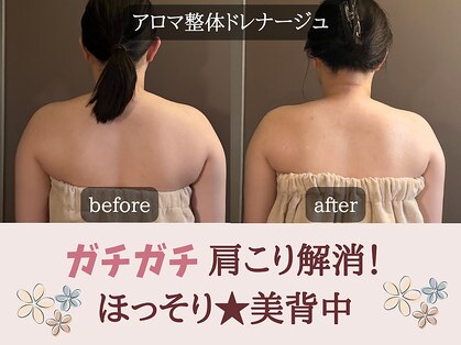 ミトラ(MITRA)の写真