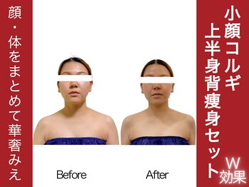 ニコワ(Nicowa)の写真/セット人気No1♪顔/体をまとめて華奢みえ【小顔コルギ+上半身集中痩身マシン★90分￥6980】1度で贅沢にW効果