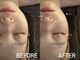アンミー(anmiiy)の写真/瞬間リフトアップ☆エアバリはanmiiyだけの特別体験。ずっと触っていたい理想の小顔に◎むくみ/ヘッド