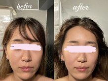 ジェミニ フェイス デザイン(Gemini Face Design)/