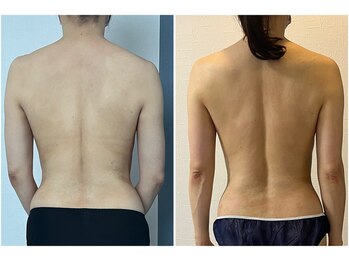 モア(moa)/腰回りスッキリ!