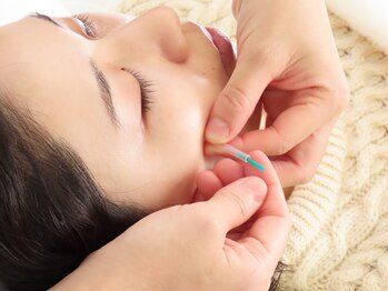 リーフル/全て使い捨ての鍼を使用