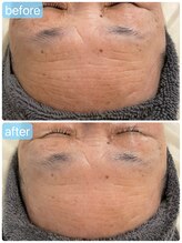 サロンドエテ(salon de ete)/シワ改善ならハーブで解決