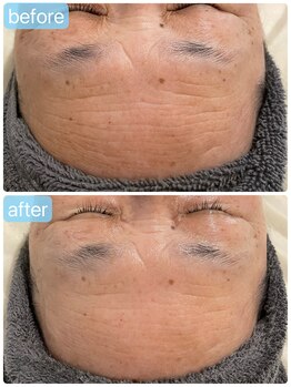 サロンドエテ(salon de ete)/シワ改善ならハーブで解決