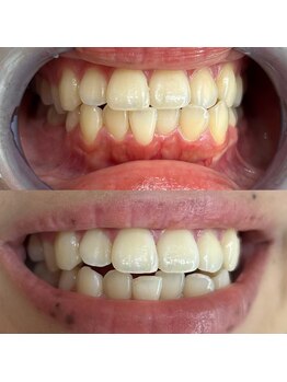 ライトビューティー 池袋店(LightBeauty)/症例写真