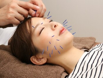いじり整体院の写真/美容鍼で小顔効果◎たるんだお顔もキュッとリフトアップし改善！速攻性の高いツボを刺激し肌の質感もＵＰ♪