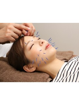 鍼灸施術を受けたい