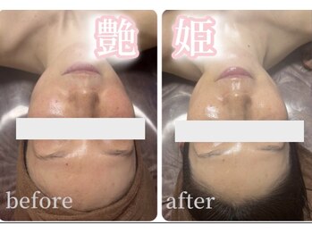 サロンデュヒャーク 志木駅前店(salon du ひゃーく)/お肌のお悩み解決に自信アリ!