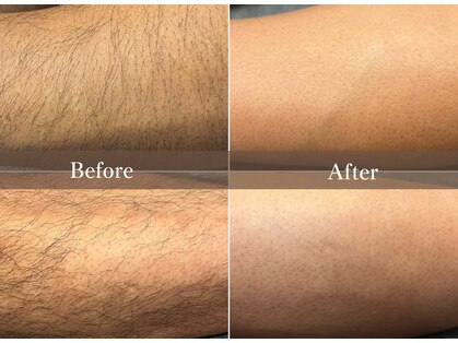 フェイシャルクレア(Cre A.)の写真