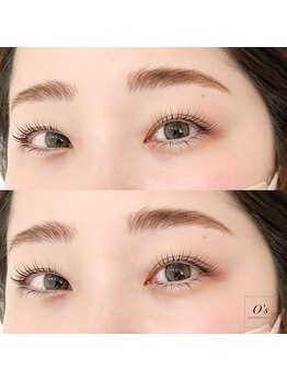 エンズ 代官山(O`s)/HBL×メーテルラッシュ