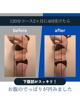 ソリデンテ 赤坂/即効性と持続性が持ち味の施術