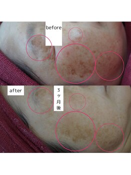 アップルミント/