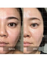 プラスボーテ 幡ヶ谷(plus beaute)/見て欲しいお肌に/北参道/原宿