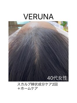 ココ 2号店(CoCo)/頭皮ケア/育毛促進/スカルプケア