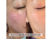 ビズエー(viz.A)/