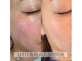 ビズエー(viz.A)/