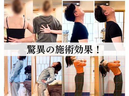 鍼灸整骨院ゼット(Z)の写真