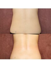 カブール三宮/1回の施術のBefore→After★