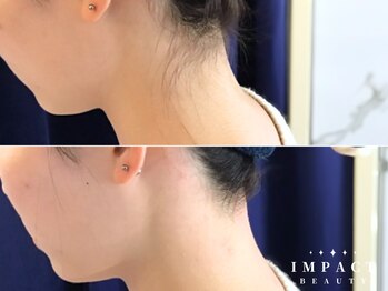 インパクト 岡山駅前サロン(IMPACT)/全然印象違います！